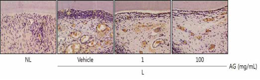 Histological photographs of TRAP-stained sections