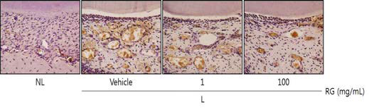 Histological photographs of TRAP-stained sections