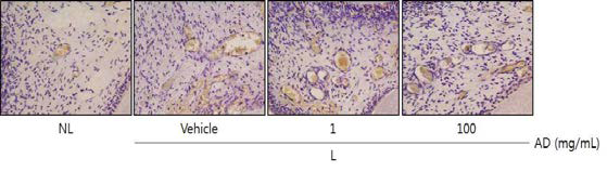 Histological photographs of TRAP-stained sections