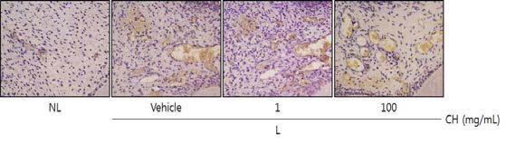 Histological photographs of TRAP-stained sections