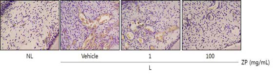 Histological photographs of TRAP-stained sections