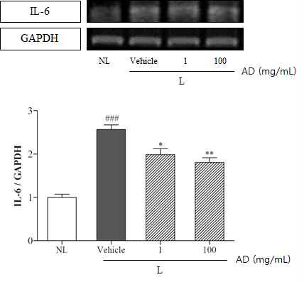 Effect of topical AD treatment on expression of IL-6 gene