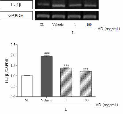 Effect of topical AD treatment on expression of IL-1β gene