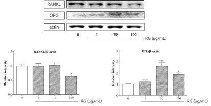 RANKL and OPG expressions