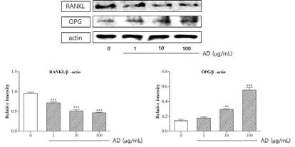 RANKL and OPG expressions