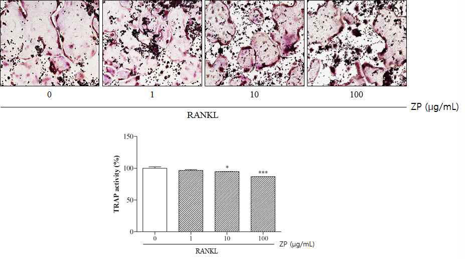 Effect of ZP treatment on osteoclast differentiation of RAW264.7 cells