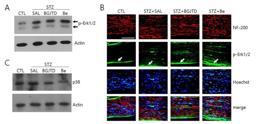 Induction pattern of phospho-Erk1/2 and p38 proteins in the sciatic nerves of STZ-induced diabetic animals after different treatments. (CTL; untreated control, SAL; saline injection).