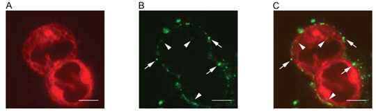 특정단백질을 합성하지 않는 배아 줄기세포(a)에 줄기세포유래 미세입자를 처리하였을 때(b) miRNA의 이동과 이로 인한 배아줄기세포에서 단백질 합성이 일어남(c).