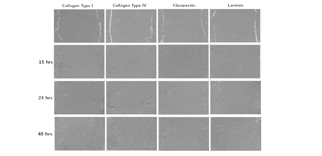 세포외기질 성분에 따른 지방 유래 간엽줄기세포의 세포 이동성의 차이