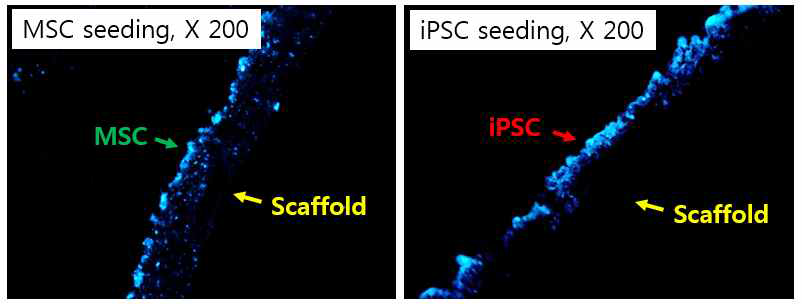 지지체에 간엽줄기세포(MSC)와 환자 맞춤 유도만능 줄기세포(iPSC)를 각각 도말한 후 nude mouse 이식 전의 지지체 내 세포 분포 확인.