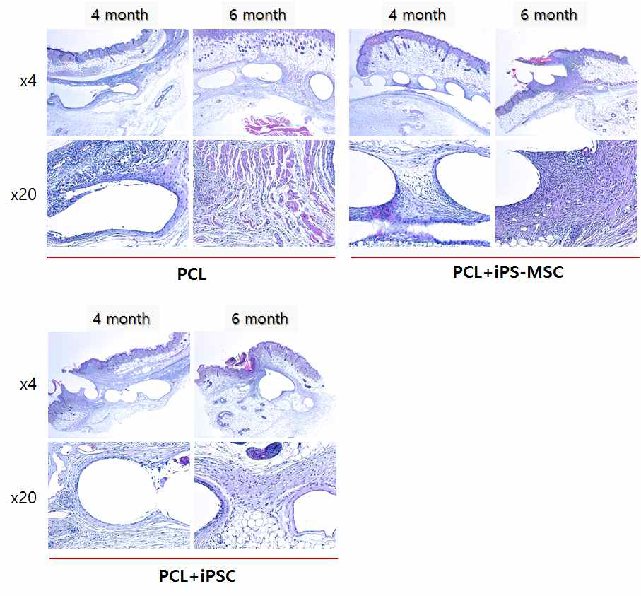 iPS-MCS와 iPSC가 도말된 지지체의 nude mouse 피하 이식 후 조직학적 관찰 (4, 6개월)