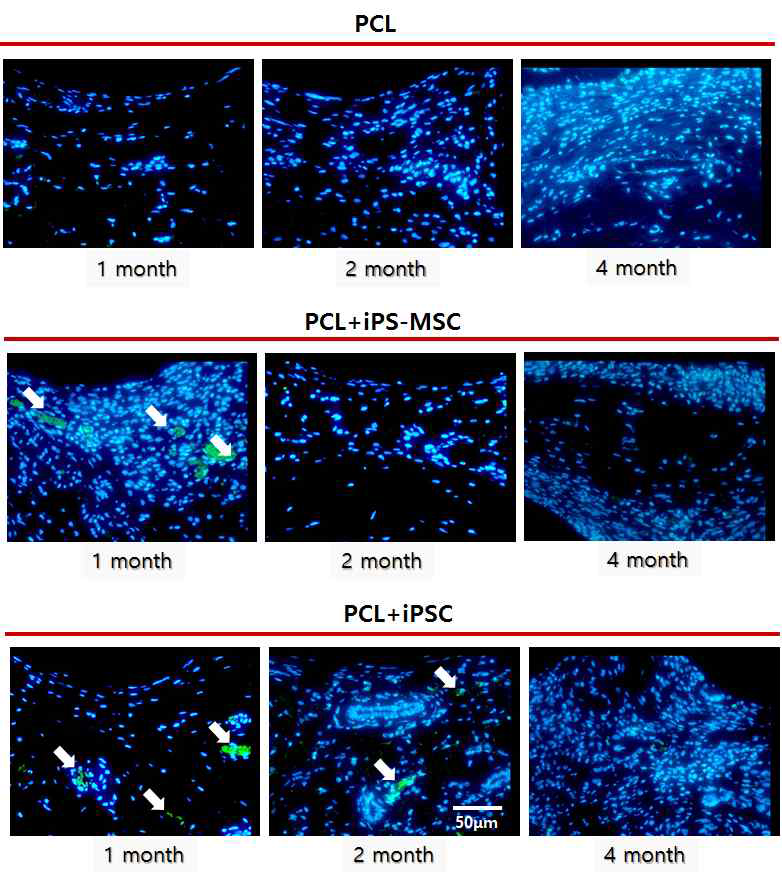 Human nuclei 항체를 통한 피하조직 이식 후 세포추적