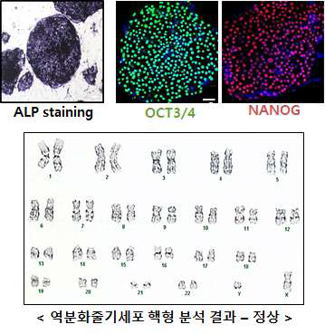 말초혈액유래 역분화 줄기세포성을 확인하기 위해 ALP staining, Immunofluorescence staining, 핵형 분석을 수행