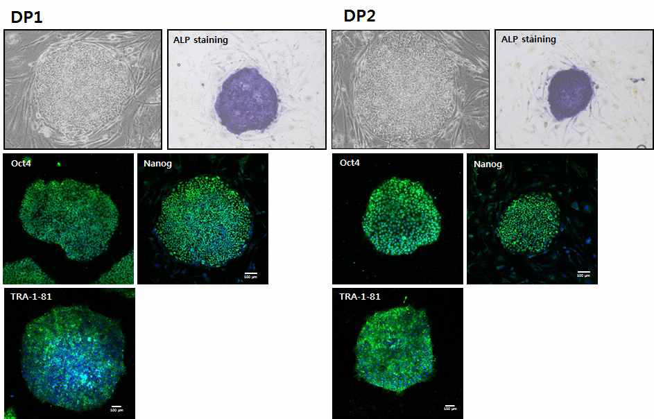 모유두 세포유래 역분화 줄기세포성을 확인하기 위해 ALP staining 및 면역형광 염색을 수행