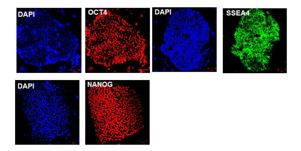 Human dermal fibroblast 유래 iPSC가 stemness marker인 Oct4, SSEA4, Nanog를 발현하고 있음을 immunofluorescence staining으로 증명함.