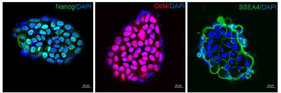 Matrigel에서 유지한 역분화 줄기세포의 성상을 확인하기 위하여 Nanog, Oct4, SSEA4로 Immuno-fluorescence staining 수행함.