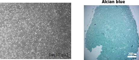 간엽줄기세포 유래 간엽세포의 분화능 증명