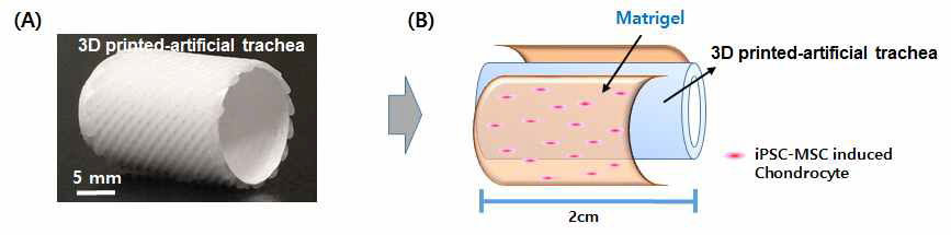기관재생유도관 표면의 세포 도입법 고안. 3D 프린팅기법으로 제조된 인공 기관지지체(A)와 scaffold 표면의 세포도입법으로서 Matrigel® 에 iPS에서 분화된 연골세포를 담지 후 지지체 표면에 도포하는 방법(B)의 모식도
