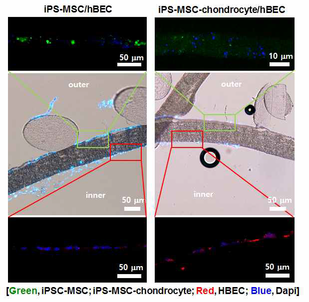 PKH-67에 부착된 iPS-MSC-chondrocyte와 iPS-MSC는 지지체 외벽에 도말하였으며, PKH-26에 부착된 hBEC는 내벽에 도말하여 세포추적한 형광이미지.