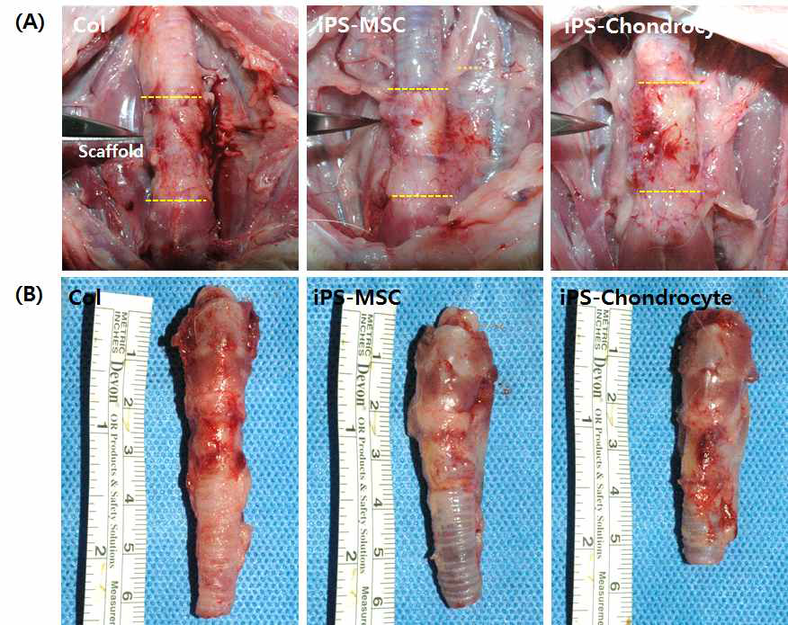 인공 기관지지체의 생체이식 4주차의 이식 부위의 육안적 관찰(A) 및 기관 적출(B)