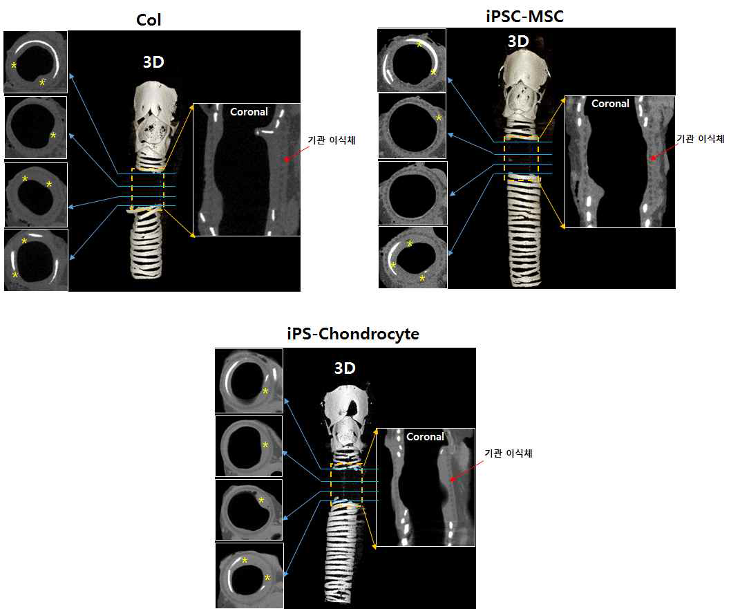 인공 기관지지체의 μ-CT 영상분석 이미지