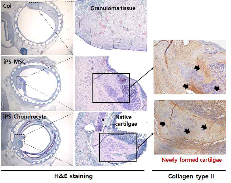 인공지지체 이식부위의 조직학적 분석 및 신생연골 재생의 특이적 면역염색을 통한 관찰