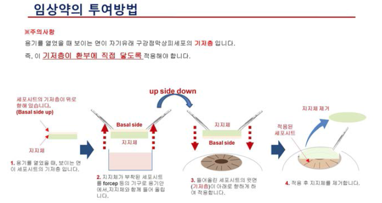 자가구강점막상피 세포시트의 투여 방법 모식도