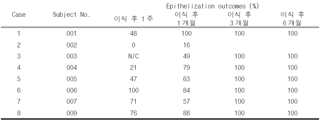 임상시험용의약품 이식 후 각막 상피화 결과