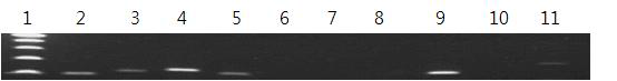 Gene expression of HLSC7 by agarose gel electrophoresis. (1: Marker, 2 : β2m, 3: HLA-A, 4: HLA-B, 5: HLA-C, 6: HLA-DP, 7: HLA-DQ, 8: HLA-DR, 9: HLA-E, 10: HLA-F, 11: HLA-G)