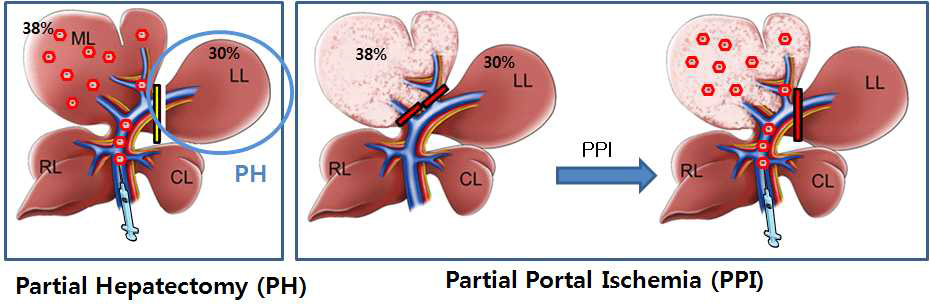 부분 간 절제와 부분 문맥 허혈 모델의 방법 모식도