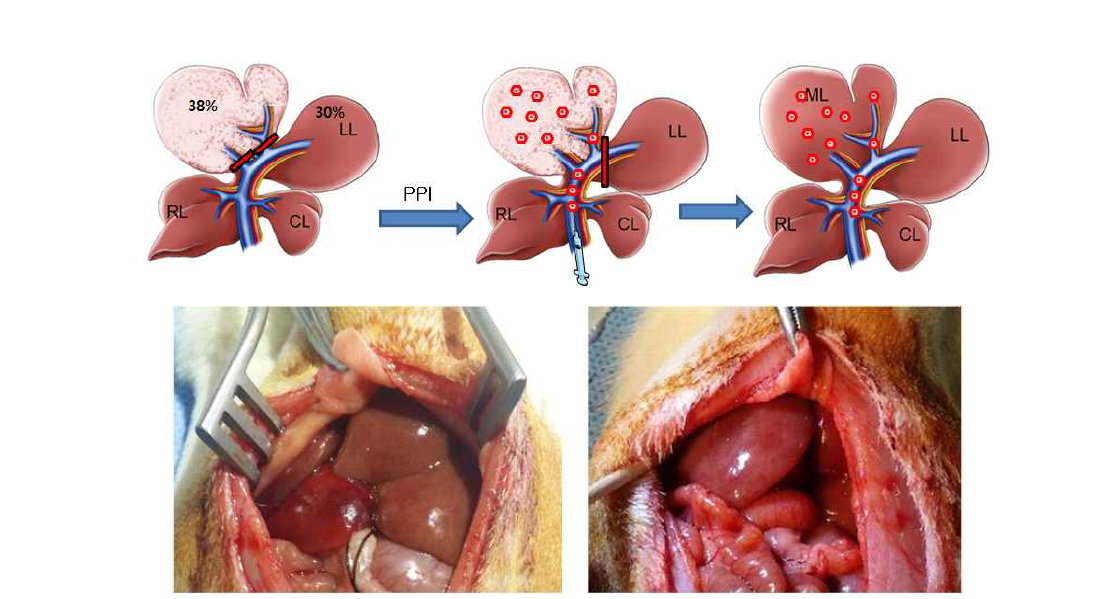 Partial portal ischemia 90분후 세포이식 방법 및 세포이식 전후의 간 사진