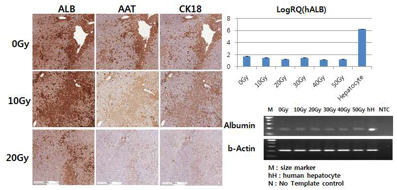 각 방사선 조사 1일 뒤 간세포를 이식하고 4주후의 간조직 면역화학염색 결과 및 조직에서의 human albuimin gene 발현량 비교