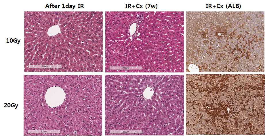 10Gy, 20Gy 방사선 조사 1일 뒤, 간 줄기세포 이식 후 7주 뒤 간 조직의 H&E staining 및 human albumin 면역화학염색 결과