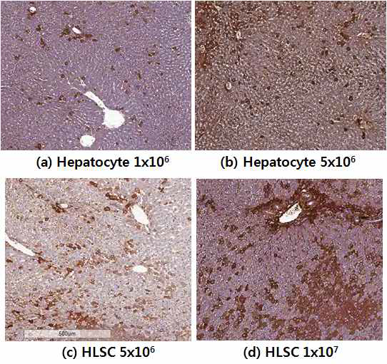 간세포와 간 줄기세포의 각각의 농도에 따른 이식 후 간조직 내 분포