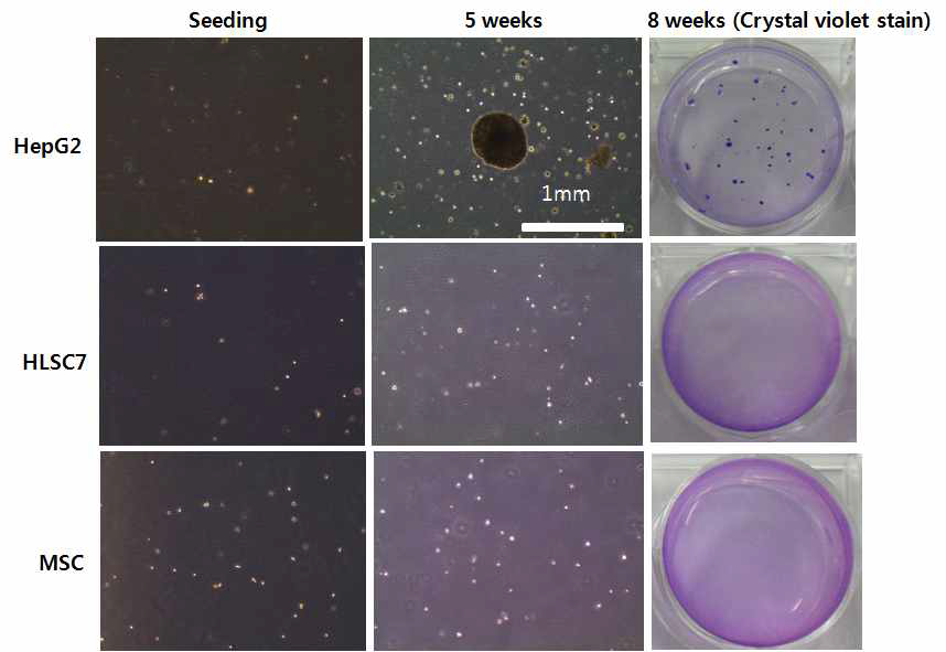 In vitro에서의 간 줄기세포의 종양원성 확인