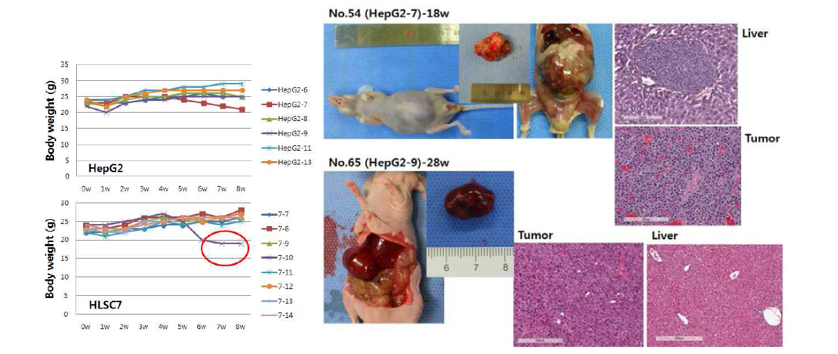 간 줄기세포의 간문맥을 통한 이식 후 종양원성 확인