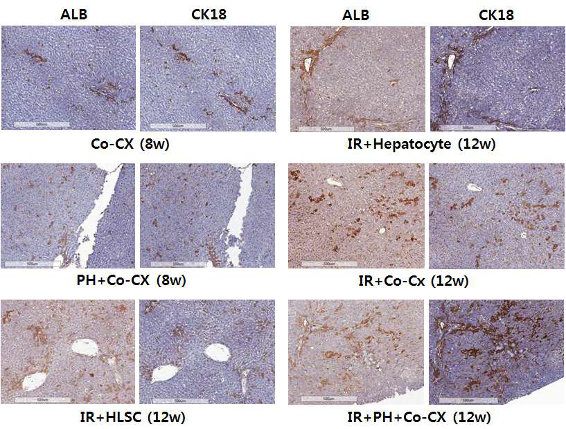 간세포, 간 줄기세포의 동시 이식방법과 방사선 조사법에 부분 간 절제법을 접목하여 8주-12주 후 간 조직이 human ALB, CK18 면역화학염색 결과