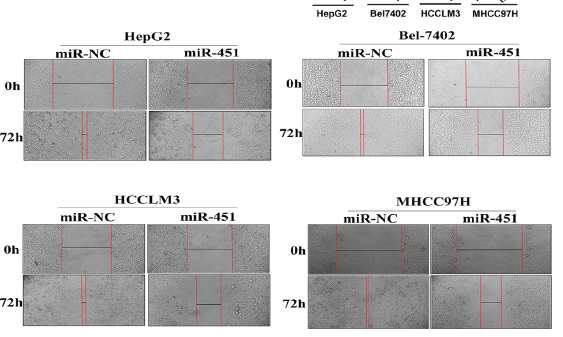 간암세포의 이동력을 확인하기 위한 Wound healing assay