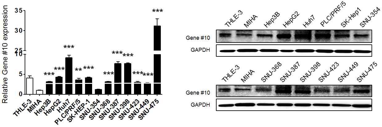 정상 간세포주 및 간암 세포주에서 Gene #10의 mRNA, 단백질 발현 분석