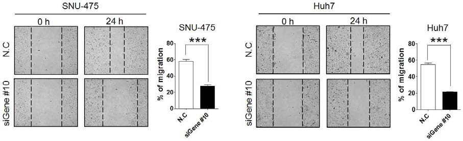Gene #10의 발현 저해에 따른 간암세포의 이동성변화 확인