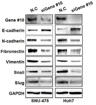 Gene #10의 발현 억제에따른 EMT 마커들의 발현변화 확인