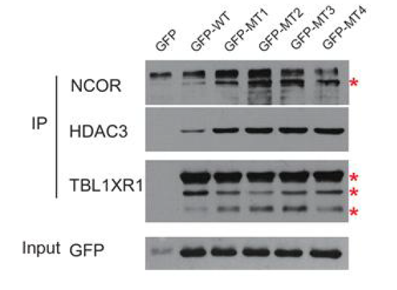 면역침강법을 통한 TBL1XR1과 결합단백질의 친화도 비교