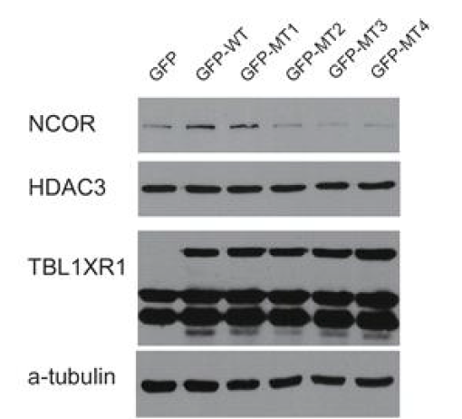 TBL1XR1의 발현에 따른 세포내의 NCOR,HDAC3의 발현정도 조사