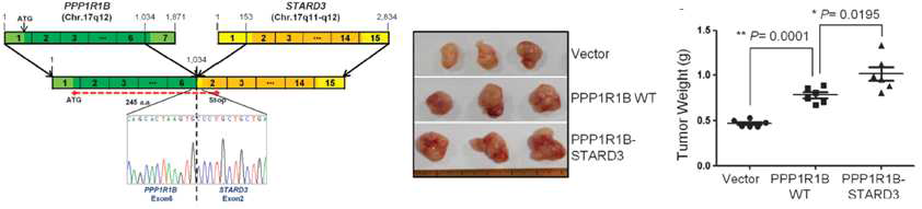 RNA-seq을 통해 동정한 PPP1R1B-STARD3 fusion transcript 확인 및 융합 유전자 전사체 과발현에 의한 마우스에서 종양형성 분석