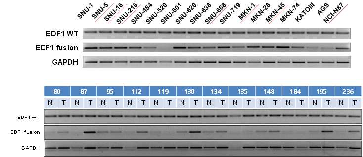 중합효소연쇄반응에 의한 정상 및 융합 EDF1 유전자의 발현 확인