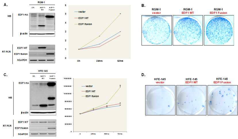 정상 및 융합 EDF1 과발현에 의한 세포 성장 및 군집형성능 변화 확인