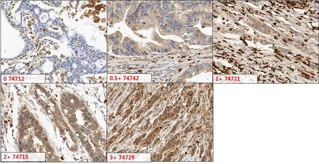 PADI2의 세포질 (Cytoplasm) 염색