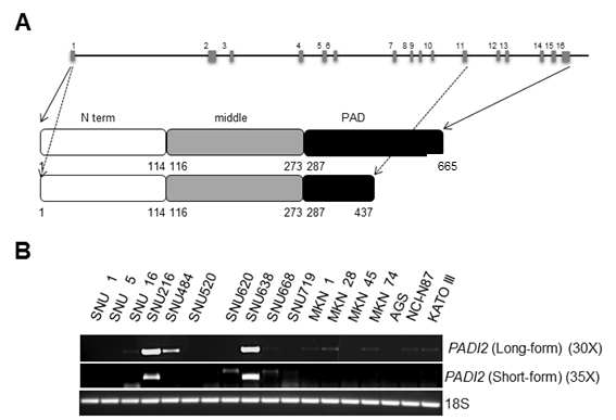 18개의 인간 위암 세포주에서 PADI2 long- 및 short-form 유전자 발현 분석