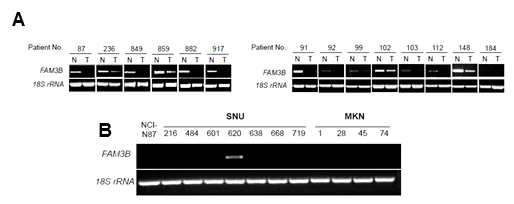 위암 환자 조직 및 위암 세포주에서 RT-PCR을 이용한 FAM3B 유전자 분석
