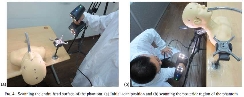 핸디형 3D 스캐너를 방사선치료에 적용한 첫 사례. 환자의 자세를 검증하는데 적용하였으며, 2 mm 이내의 정확도를 나타냄.